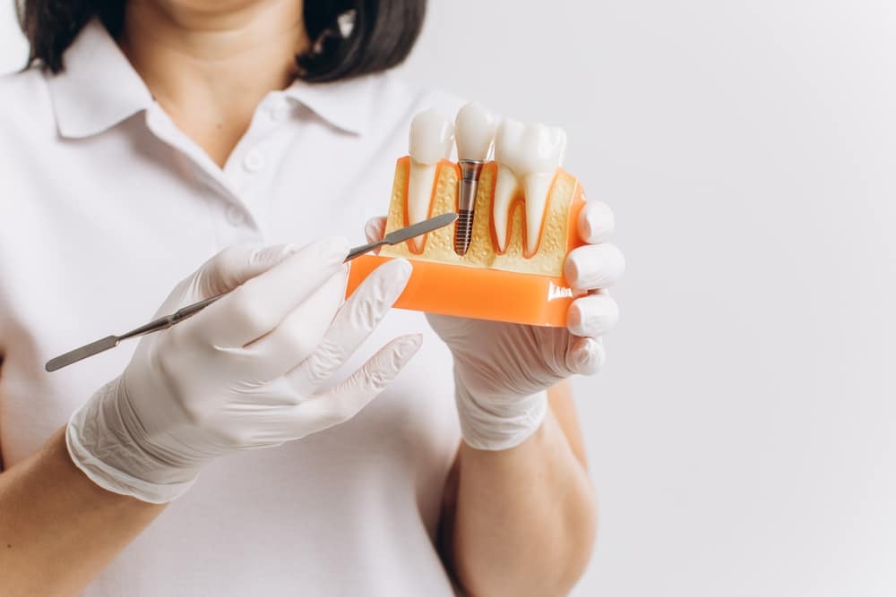 Missing Teeth? Discover Dental Implants in Madera, CA