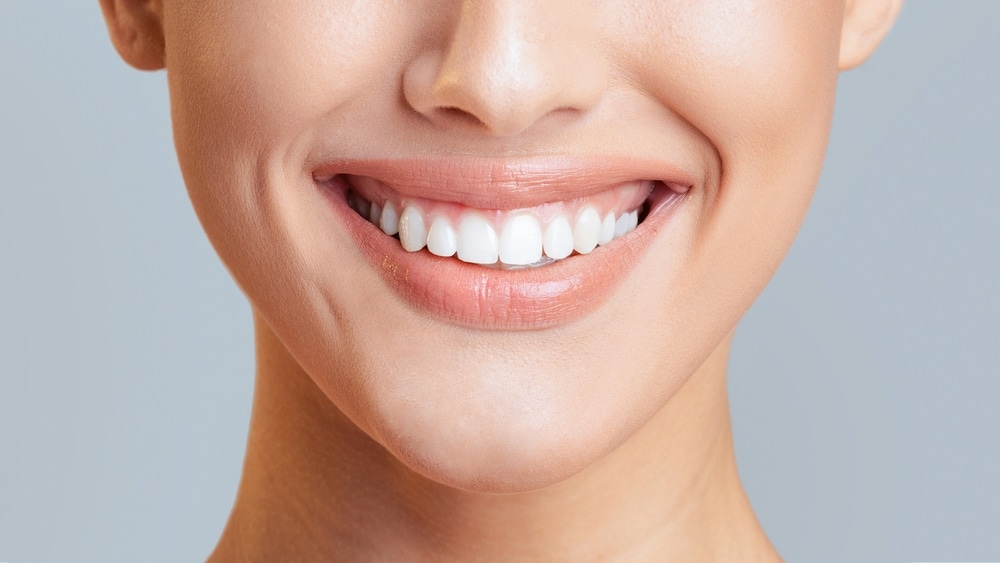 Brighten Fast With Teeth Whitening in Sanger