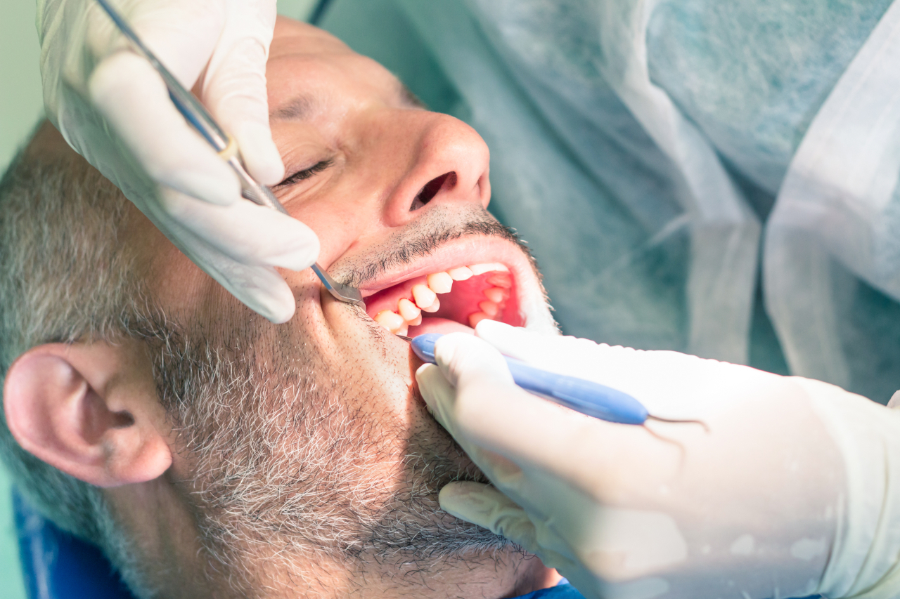 Knocked-Out Tooth Emergency: What to Do to Help Save Your Tooth